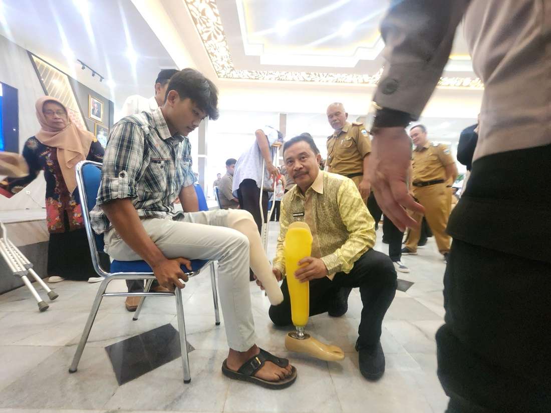 Pj. Bupati Garut Resmi Buka Penyaluran Bantuan Kaki Palsu dan Penyuluhan Bahaya Diabetes